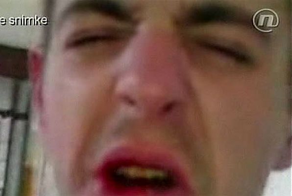 Pijani Milinovićev nećak divljao po bolnici