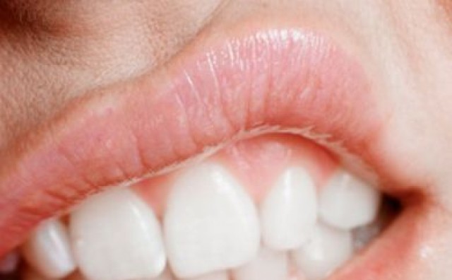 3 prirodne vodice za usta koje će otjerati neugodne mirise