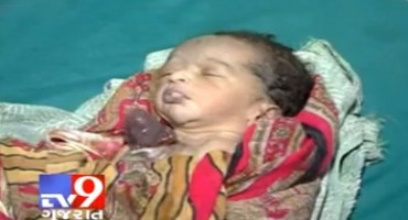 U Indiji rođeno dijete sa srcem izvan prsa