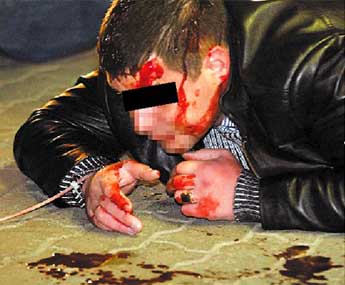 I to je moguće: Djevojka pretukla dečka jer nije želio seks