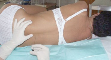 Evo kako se riješiti bolova u leđima