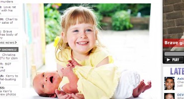 Blizanke rođene u razmaku od četiri godine