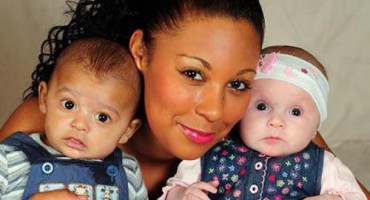 Rođeni blizanci različite boje kože