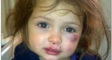 vrtić, tuča, policija