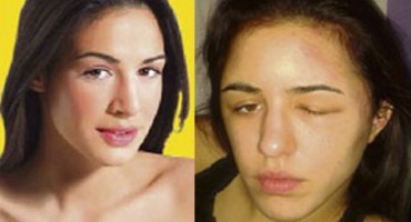 Srpsku manekenku umalo ubio color šampon