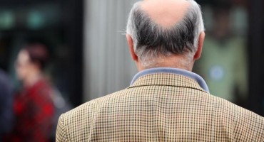 kosa, lijekovi, žena