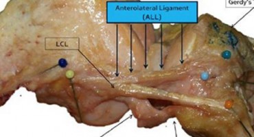 Belgijski kirurzi, novi dio ljudskog tijela, ligament, prednjeg križnog ligamenta, sportska povreda