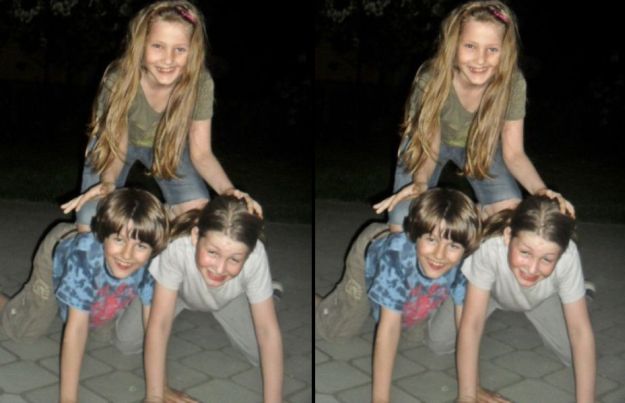 Lajkom na Fejsu pomognite djevojčici koja jedina u Hrvatskoj boluje od Parry-Rombergova sindroma!