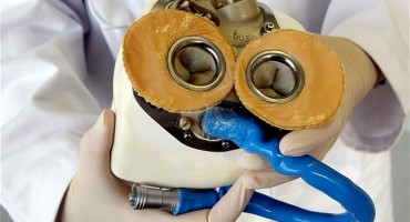 biomedicinska tvrtka Carmat, srce, Pariz, bolnica Georges Pompidou, Umjetno srce