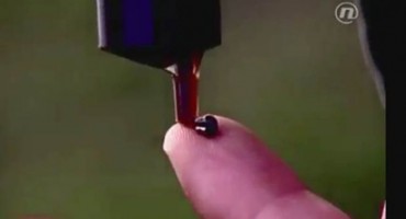 Imao je 70 tumora i nekoliko tjedana života: Nakon novog lijeka su nestali