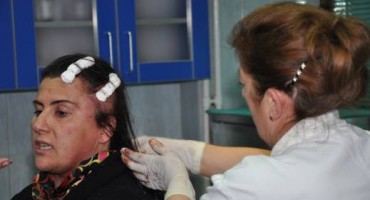 bejzbol palicom, novinarka, Lidija Nikčević, crna gora