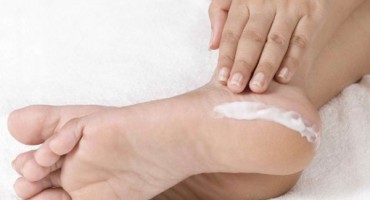 Ispucale pete – kako ih se riješiti 