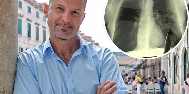 Senzacionalno otkriće hrvatskog znanstvenika 'Za 4 godine moći ćemo liječiti rak!'