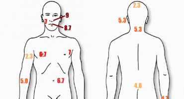 Neugodna mjesta na tijelu gdje vas može ubosti pčela