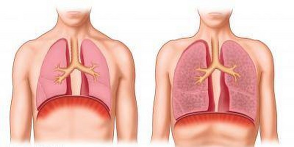 Tuberkoloza je još uvjek aktivna i opasna 