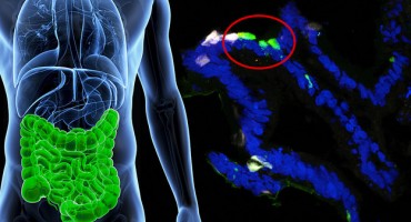 Sveučilište Columbia, inzulin, liječenje dijabetesa tipa 1