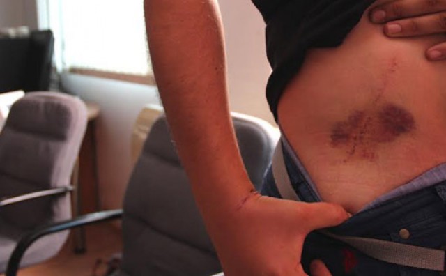 Mostar: Policajci su me brutalno tukli, moji prijatelji nisu napali policijsku postaju