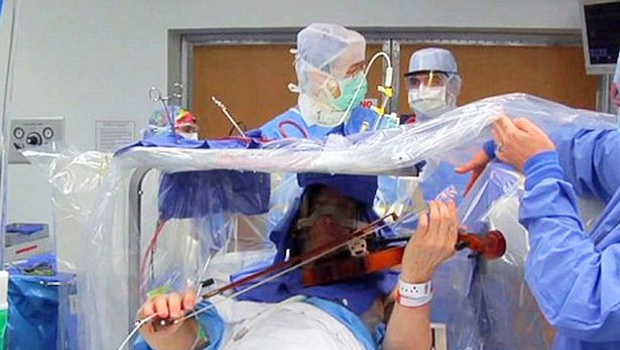 Nevjerojatno: Violinist svirao violinu tijekom operacije mozga!