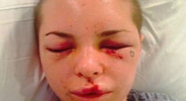 Porno zvijezdu brutalno pretukao MMA borac zvani Ratni stroj