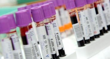 samoubojstvo, krv, SKA2