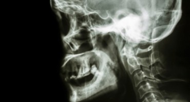 Stalno mu curila krv iz nosa: Otkriveni uzrok sve ostavio u šoku