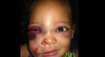 dijete, vrtić, nasilje