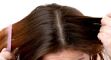 Zbogom prhuti! 5 trikova iz vaše kuhinje