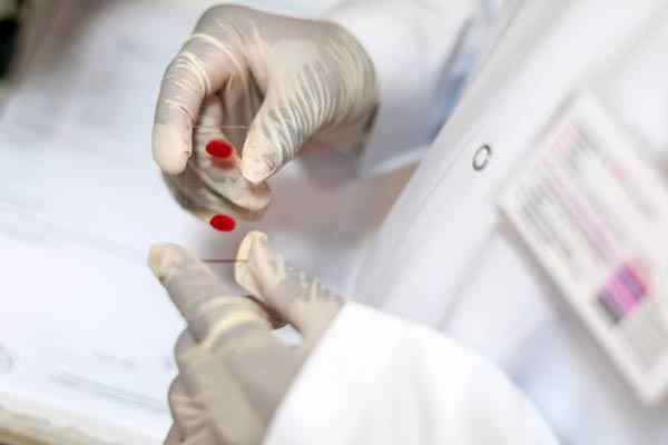 hiv