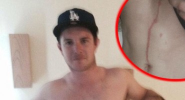 Životinja mu se kroz ožiljak zavukla u kožu