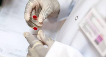 Samo trećina zaraženih Amerikanaca drži HIV pod kontrolom