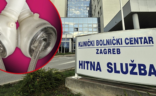 Hrvatski liječnici ugradili prvo umjetno srce