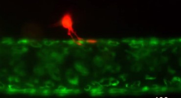 Ovako se ljudskim organizmom širi rak