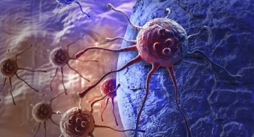 Najraniji simptomi raka kod muškaraca