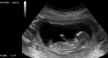 Nevjerojatna snimka ultrazvuka