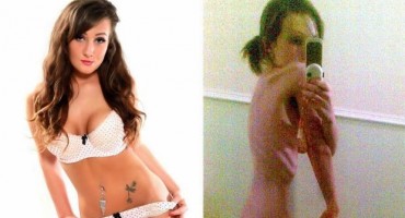 Jela je jabuku dnevno, pila je laksative i imala je samo 27 kilograma