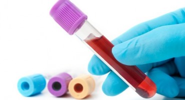 zdravlje, krv, darivanje krvi