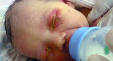 U šumi pronađena napuštena beba potpuno prekrivena mravima, ali Bog nije dopustio da umre!