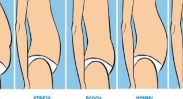 Kakav je vaš trbuh? Prepoznajte koji ste tip i ovako ga učvrstite