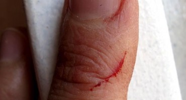 bolovi, ozljede, razlozi