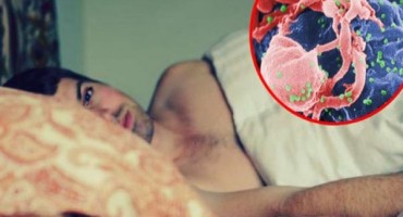 Namjerno pokušavaju da se zaraze sidom!