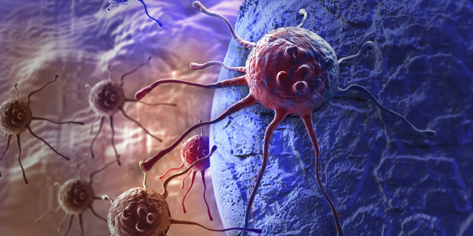 tumor