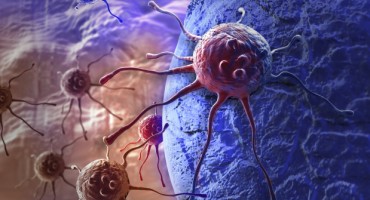 Test urina nova je nada za oboljele od raka gušterače