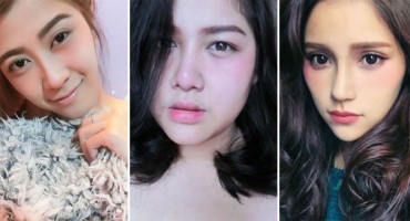  Djevojke poludjele za mamurnim izgledom pa si masovno ističu podočnjake i u njih pumpaju kiselinu