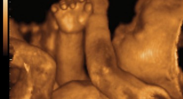 Beba u trbuhu pleše, boksa i maše!