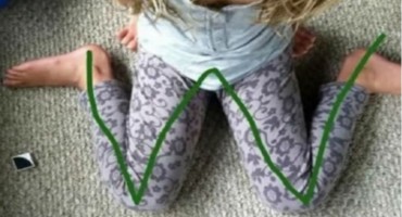 djeca rast, pravilan razvoj