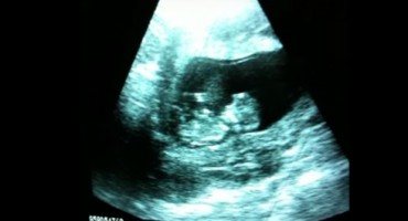 trbuh, beba, gimnastika, ultrazvuk
