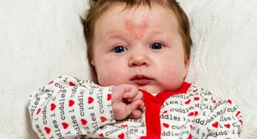 Djevojčica začeta na Valentinovo rođena s posebnim madežom