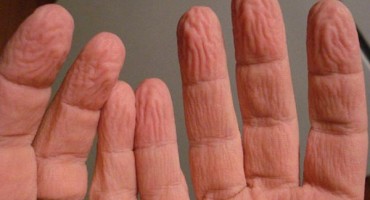 prsti