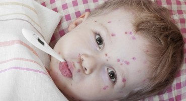 vodene kozice, pljuskavice