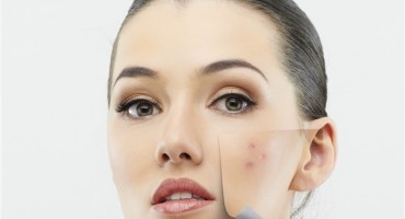 Zbog ovoga imate loš ten, a niste ni svjesni!